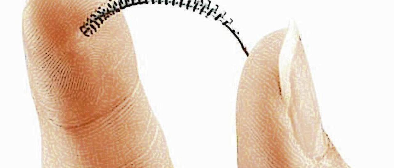 Un dispositivo Essure.