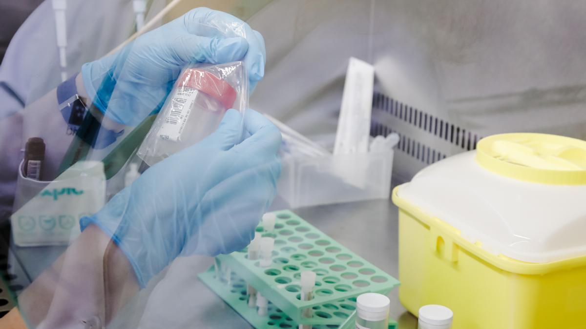Una técnico de laboratorio sostiene una de las pruebas de análisis para la viruela del mono