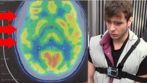 Imágenes de las pruebas neurológicas practicadas al asesino Patrick Nogueira. 