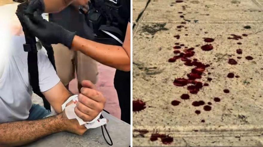 La Policía Local de Orihuela evita una tragedia tras un accidente laboral gracias a un torniquete