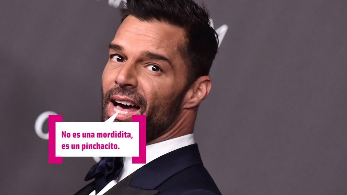 Ricky Martin y su 'living la vida botox': irreconocible