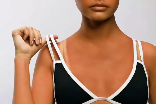 La nueva tendencia de TikTok: las marcas del bikini falsas