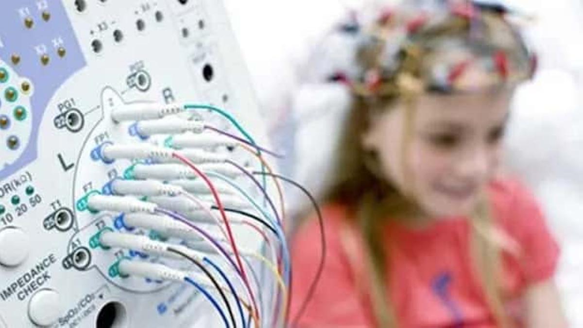 Una niña con epilepsia.