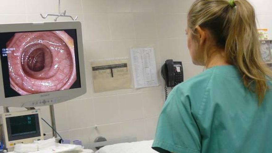 Pruebas para la detección del cáncer colorrectal.