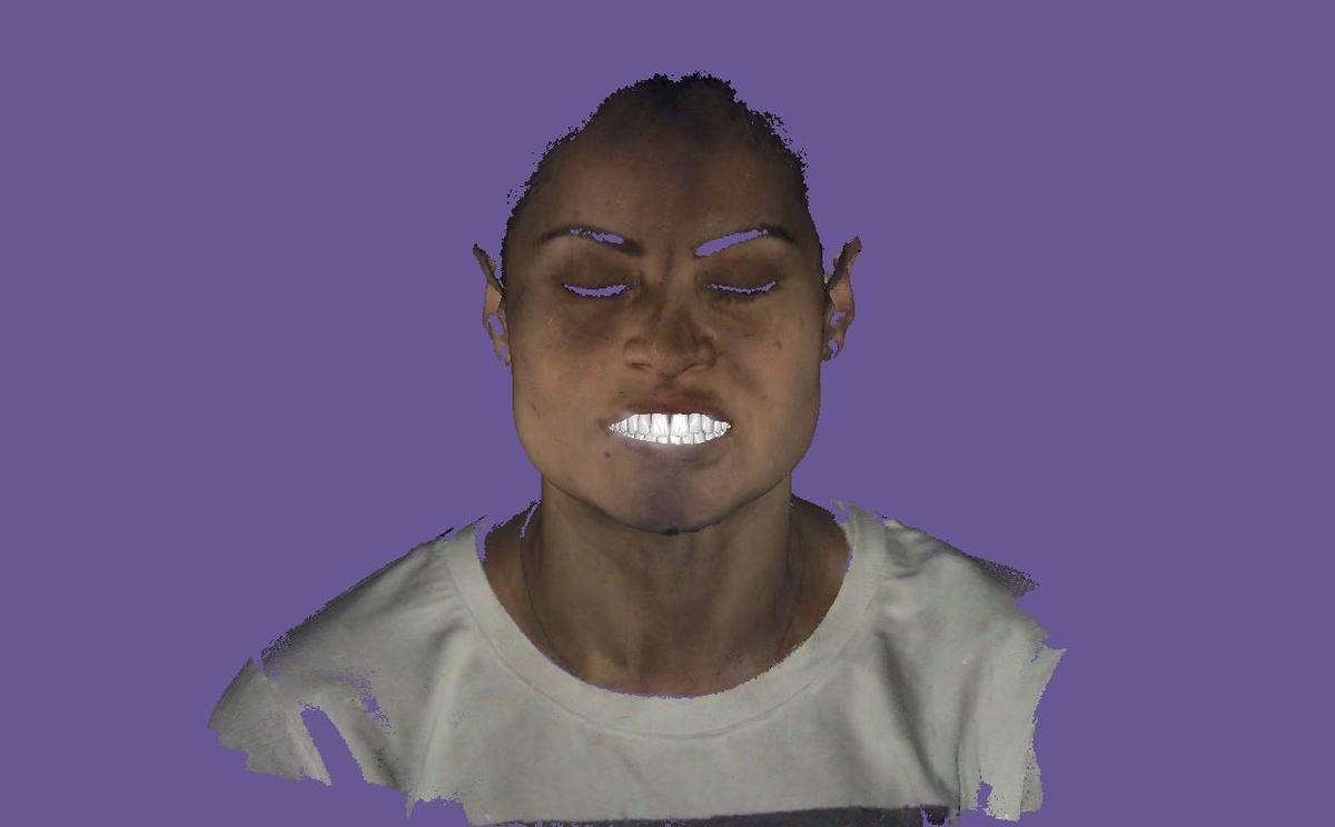 Con la última tecnología, la Clínica Fernández crea un avatar del paciente uniendo imágenes en 2D, 3D y 4D.