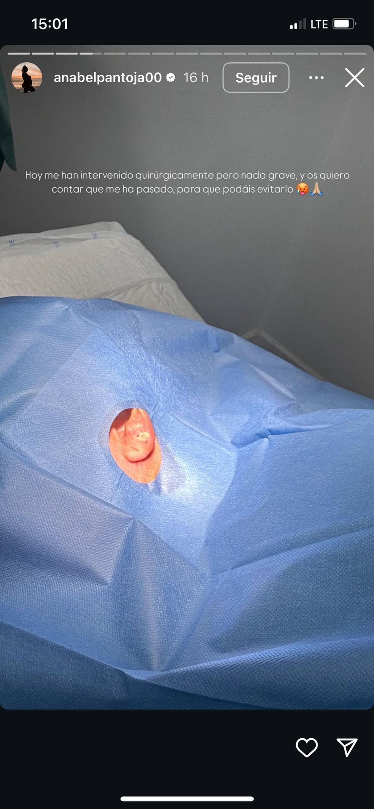 La oreja de Anabel Pantoja en la historia que publicó en Instagram
