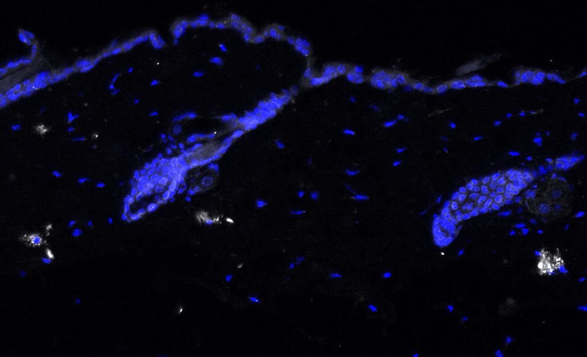 Descoberta una proteïna que si es bloqueja podria frenar l’envelliment de la pell