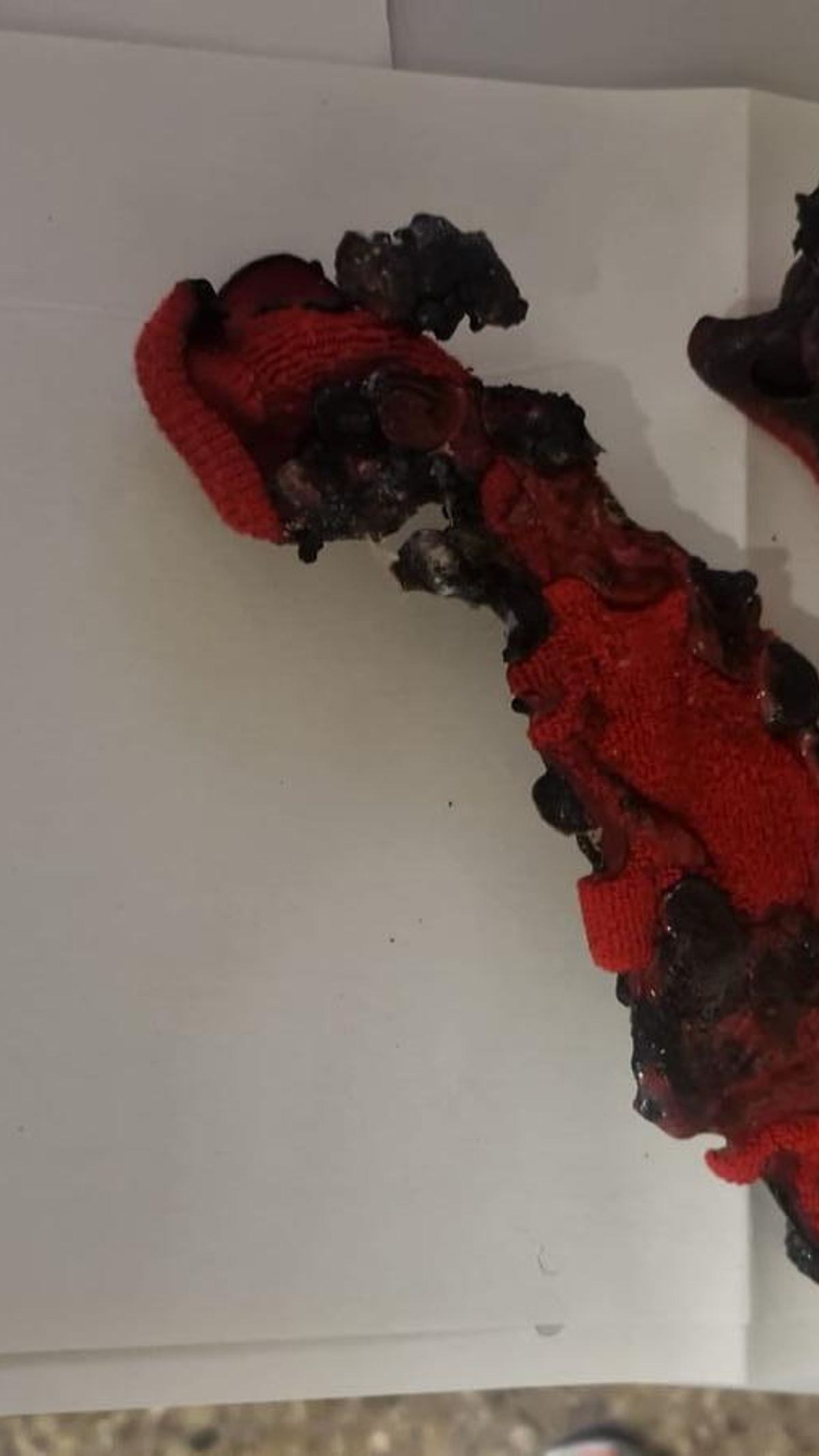 Materiales quemados en varios incidentes en el hospital Clínico.