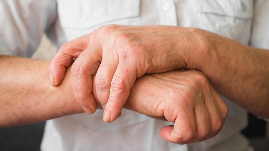 Manos con artritis: señales de alerta, diagnóstico y cómo escapar del dolor crónico