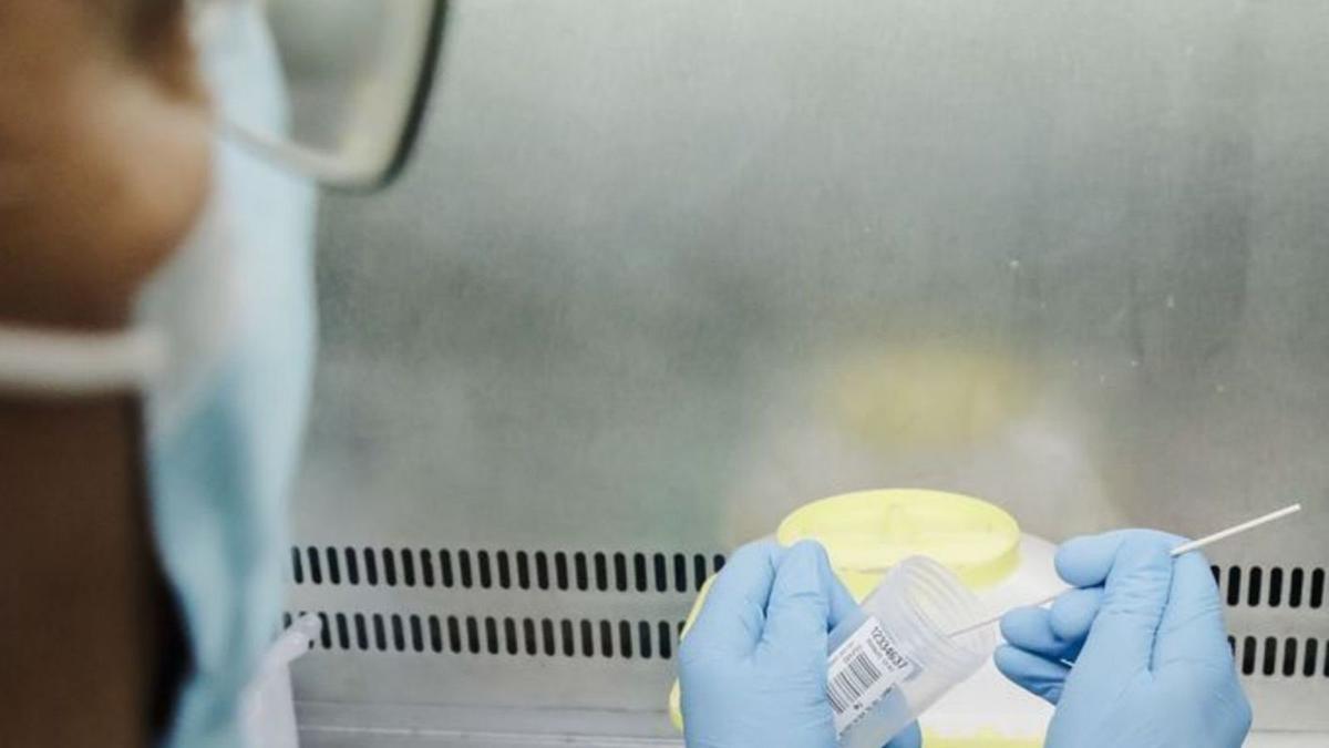Una enfermera sostiene una prueba de análisis para la viruela del mono. |  |E.P