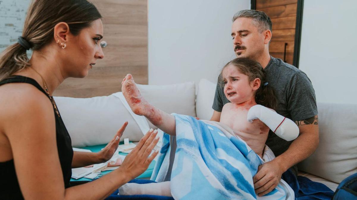 Los padres de Mía atienden a la pequeña paciente con Piel de Mariposa.