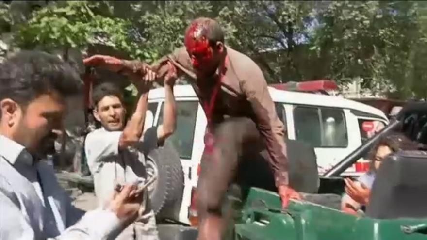 Vídeo / Al menos 80 muertos y más de 350 heridos en un atentado suicida en Kabul