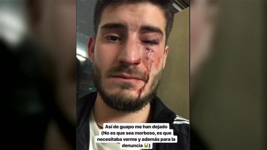 Atac homòfob al metro de Barcelona: «Em va preguntar si era ‘maricon’. Després em van agredir»