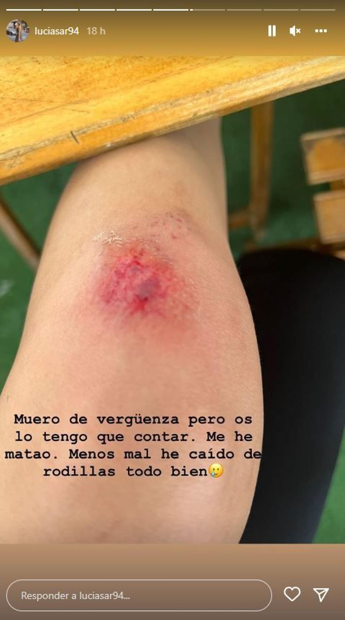 Lucía Sánchez ('La isla de las tentaciones') cuenta que se ha caído