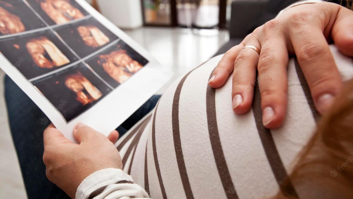 Las malformaciones uterinas pueden afectar durante el embarazado.