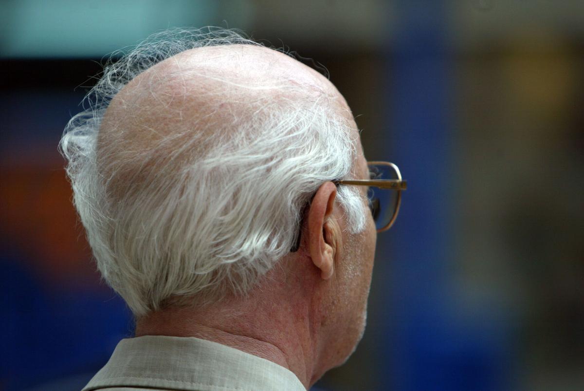 Anciano con canas y aparente alopecia androgénica