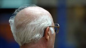 Anciano con canas y aparente alopecia androgénica