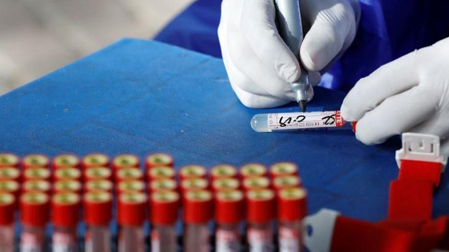 Auch ein Covid-19-Blut-Test wird im öffentlichen Gesundheitssystem nur gemacht, wenn ein begründeter Verdacht der Ansteckung besteht