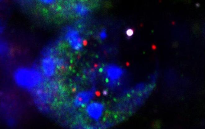 Fragmentos liberados de los núcleos de las neuronas que sufren daños en el ADN durante el aprendizaje: ADN (punto blanco grande, en el centro a la derecha), histonas (púrpura) y factores de transcripción (rojo y verde).