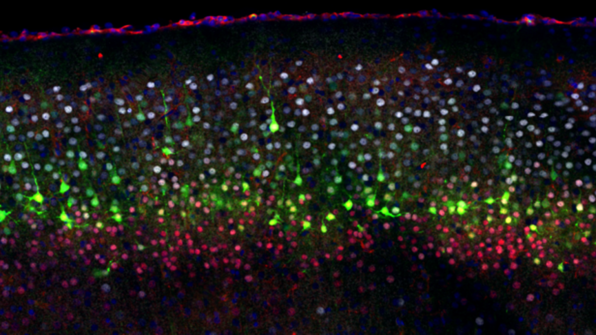 El origen evolutivo del cerebro podría estar en el estómago