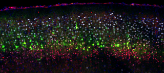 El origen evolutivo del cerebro podría estar en el estómago