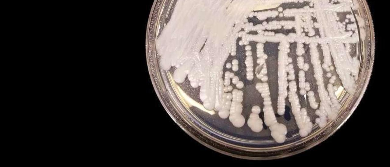 Cultivo de hongo candida auris en una placa de Petri.  // Shawn Lockhart/CDC