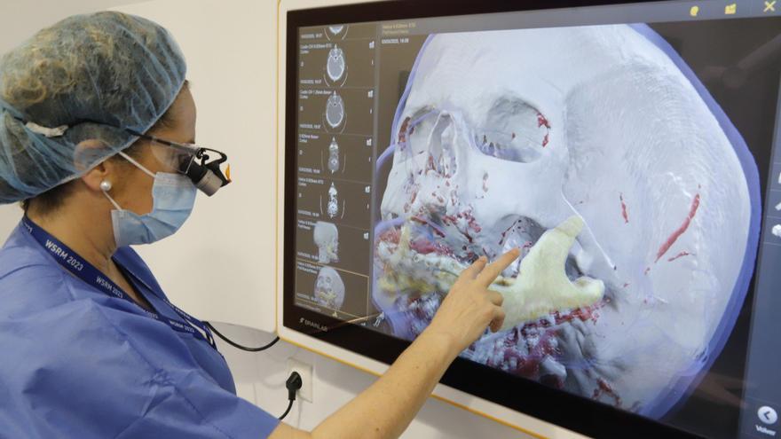 El hospital Reina Sofía, referente en realidad virtual quirúrgica
