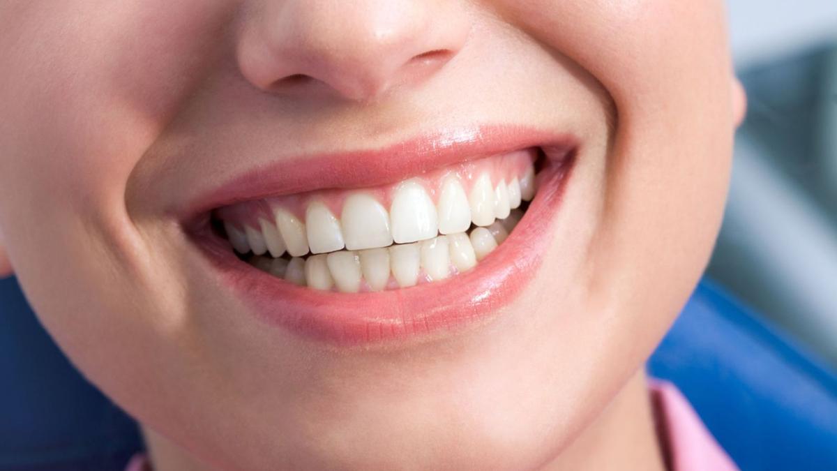 Una boca sana i amb unes dents blanques i lluents. | ISTOCK