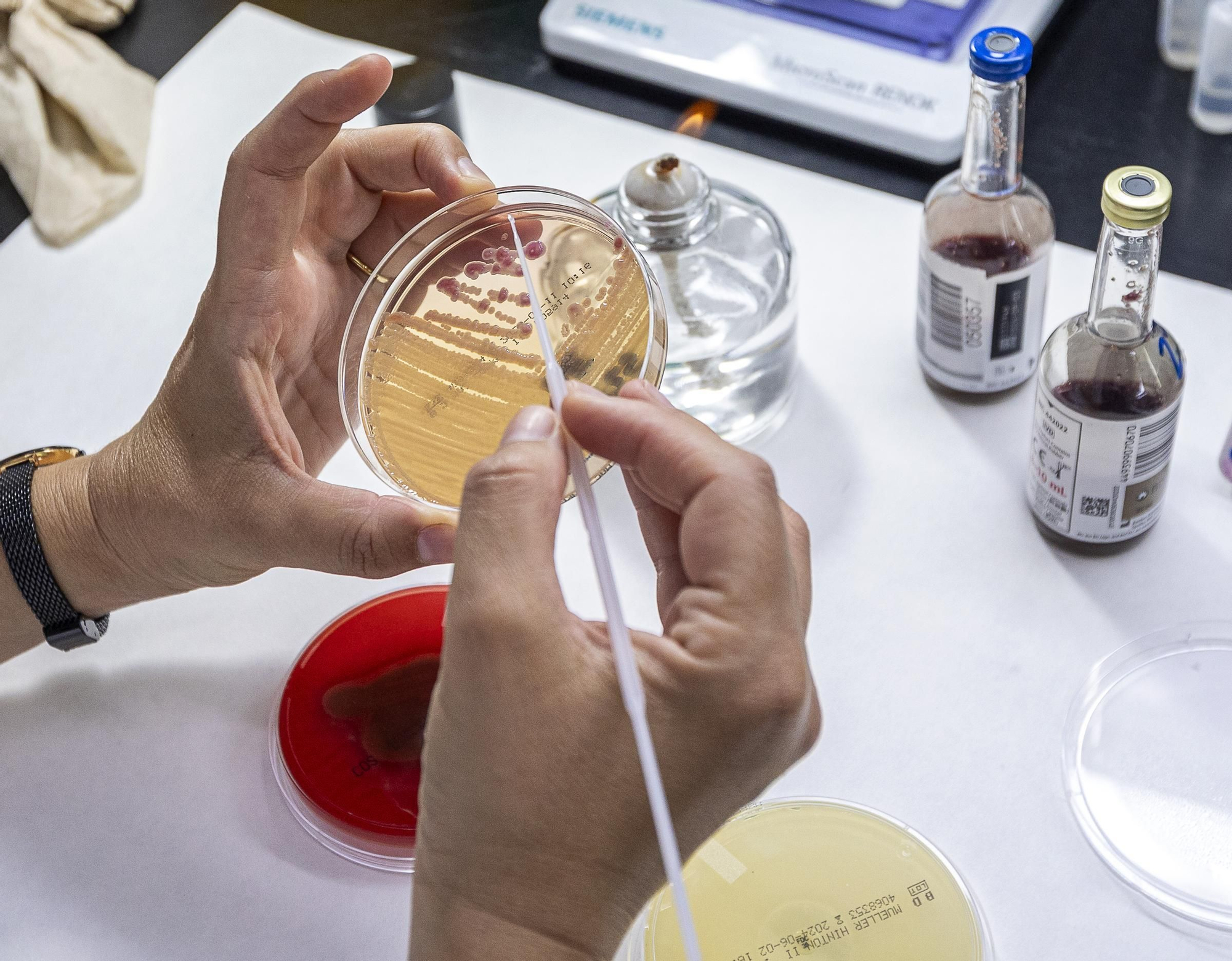 Protocolo para optimizar la respuesta rápida en código sepsis en Alicante
