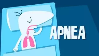 Multimedia | Más de la mitad de españoles con apnea del sueño no saben que la padecen: ¿cómo es este síndrome?