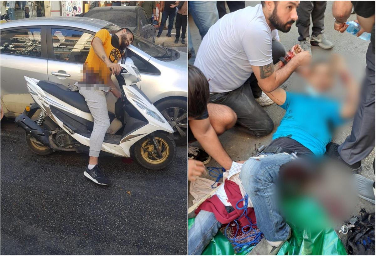 Dos hombres, herido tras la explosion de un busca en Líbano (2)