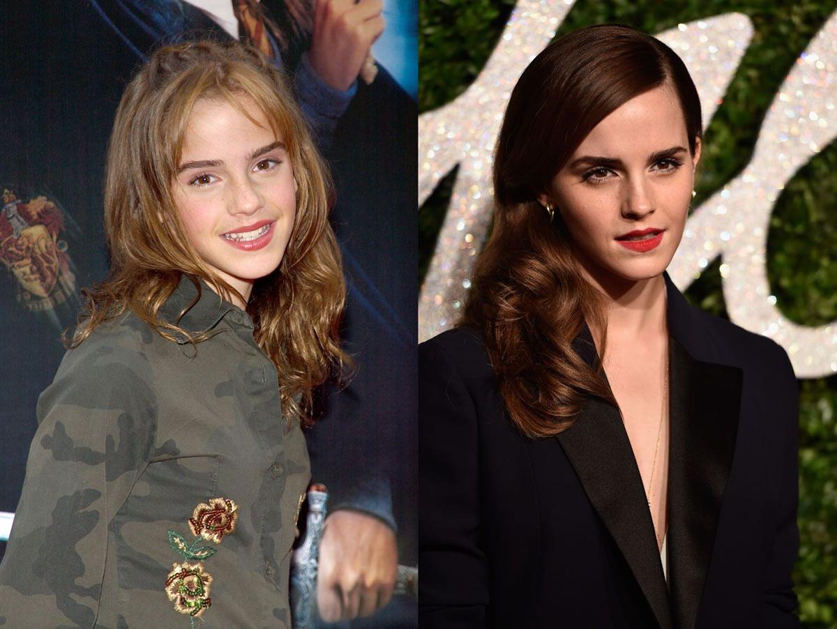 El antes y el después: Emma Watson