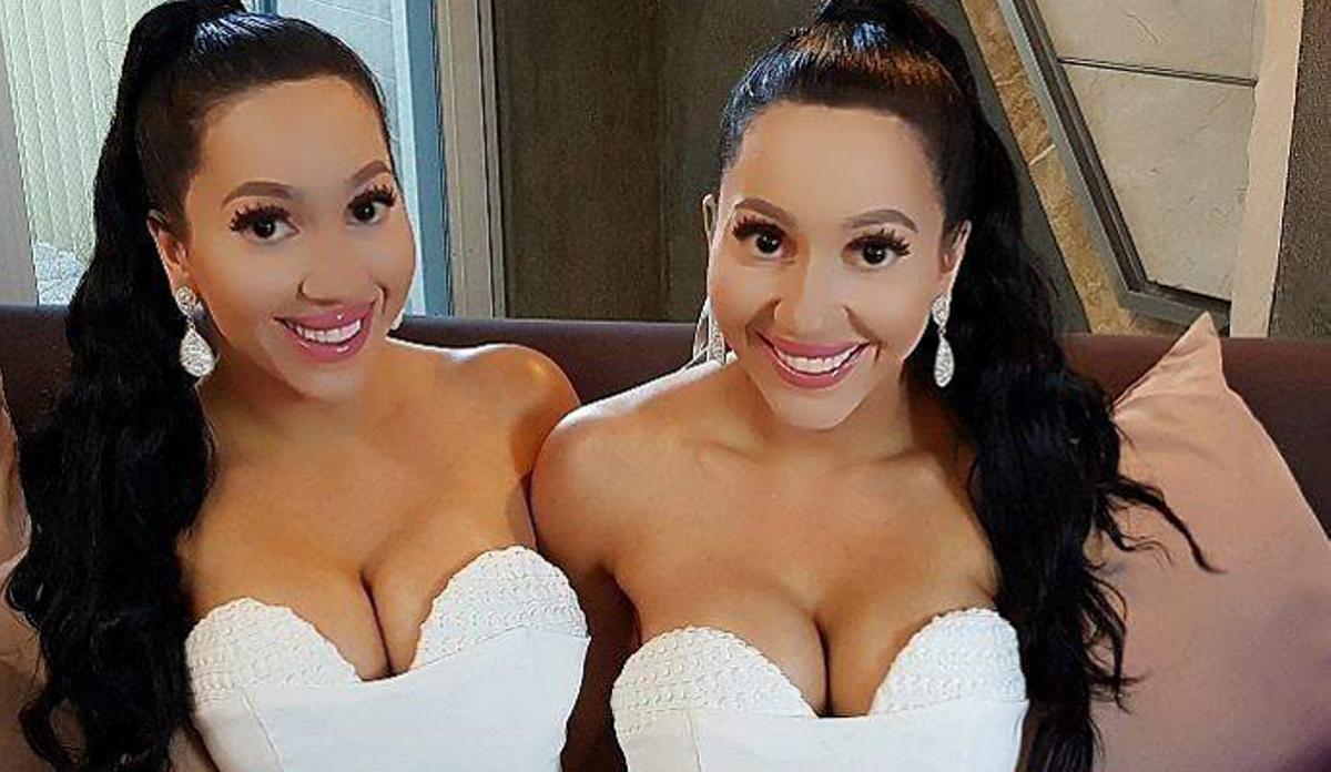 Los casos más impactantes de 'Chapuzas estéticas'