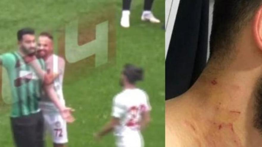 Así hirió con una cuchilla un jugador de fútbol a varios rivales en Turquía