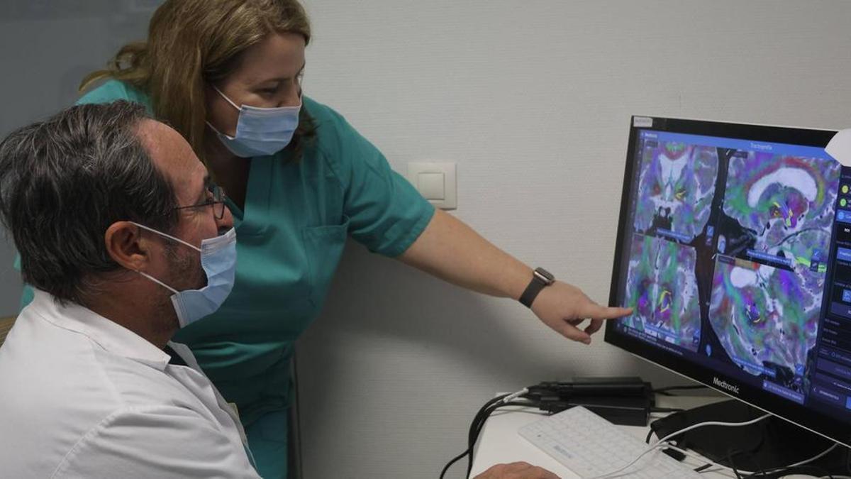 Un 'marcapasos' cerebral para mejorar la vida de los pacientes con párkinson durante 15 años.