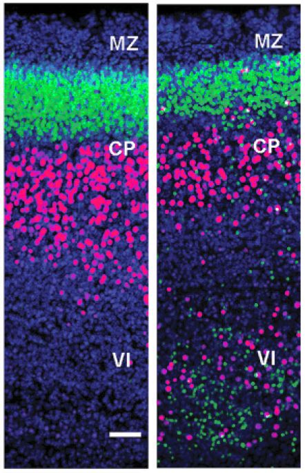 Imagen microscópica del trabajo desarrollado por el Instituto de Neurociencias en el que han empleado dos tipos de ratones modificados genéticamente que inactivan selectivamente el gen de la reelina.