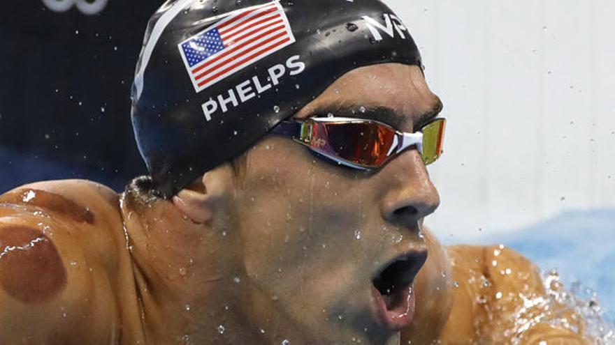 Phelps luce varios moratones en su cuerpo.