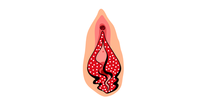 Vulva flamenca