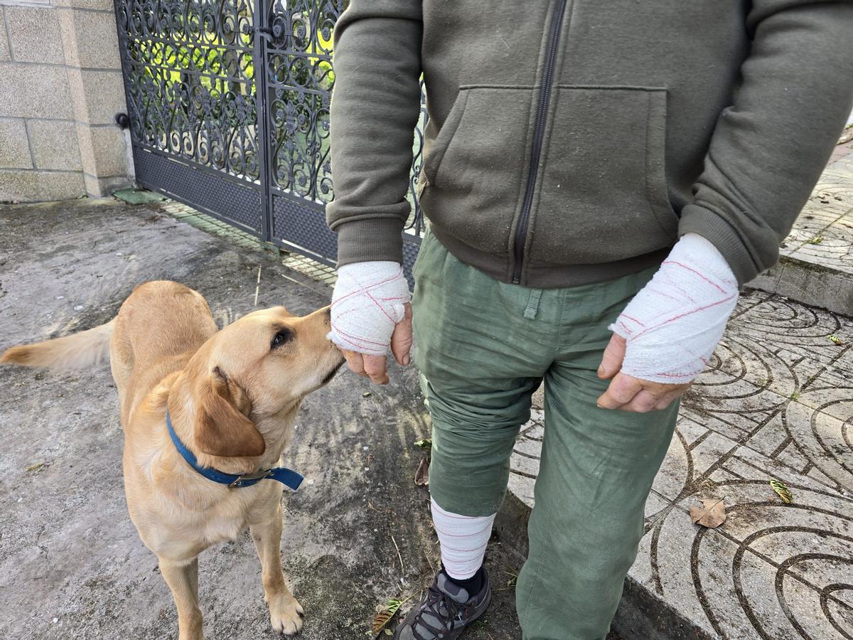 José Luis G., junto a Greco, muestra las manos y la pierna vendadas.