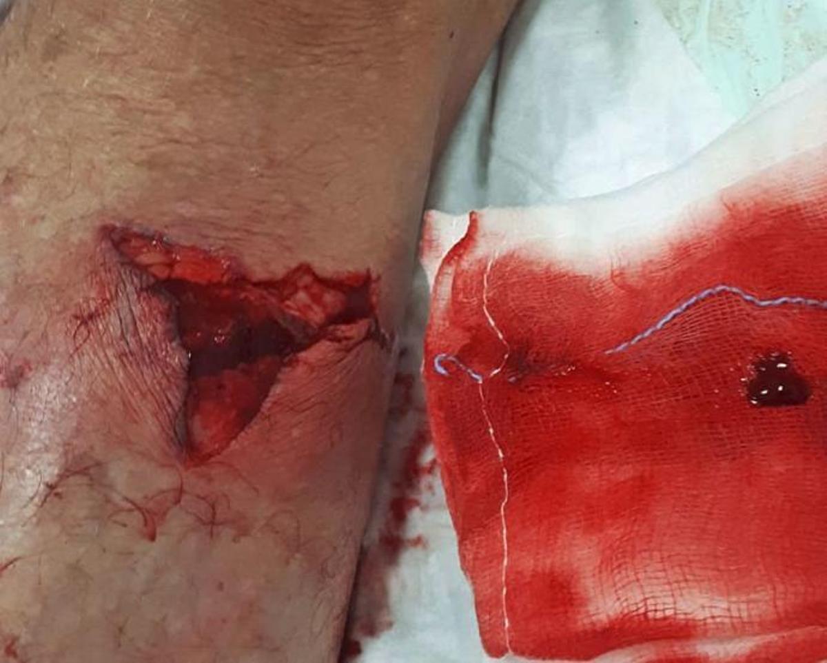 Un matrimonio, atacado por los jabalíes en su huerto de naranjos de Dénia