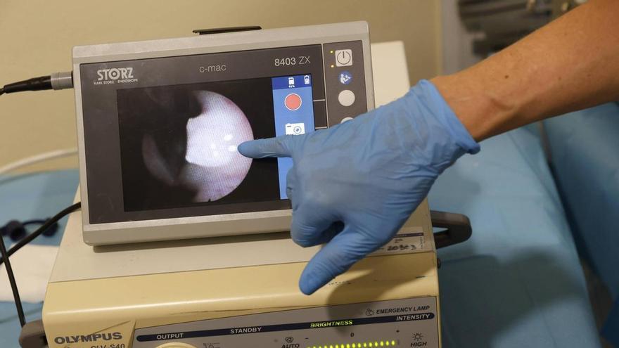 Así es una intervención con láser azul para patologías benignas de laringe en el Hospital de Cabueñes, en imágenes