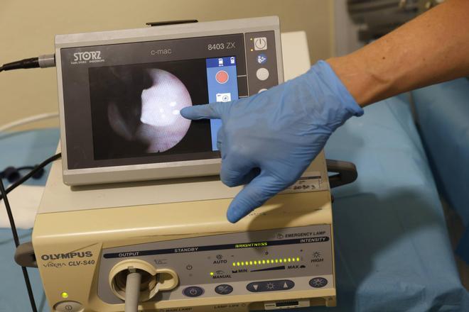 Así es una intervención con láser azul para patologías benignas de laringe en el Hospital de Cabueñes, en imágenes.