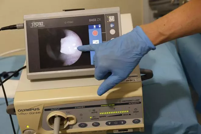 Así es una intervención con láser azul para patologías benignas de laringe en el Hospital de Cabueñes, en imágenes