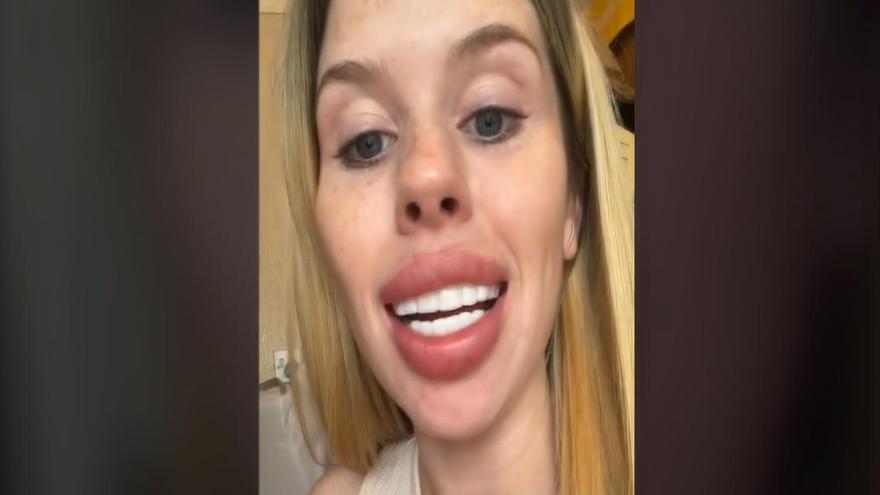 Una joven inglesa muestra el desastre que le hicieron en una clínica dental
