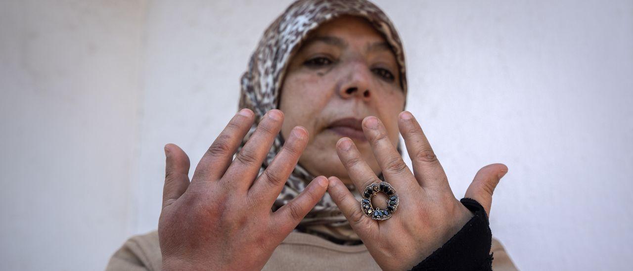 Malika Ouchitachen muestra sus manos hinchadas tras 25 años de trabajo doméstico.