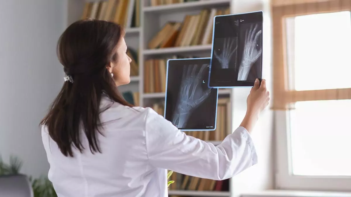 Osteoporosis: cómo evitar las fracturas que llega con la edad, sobre todo en mujeres