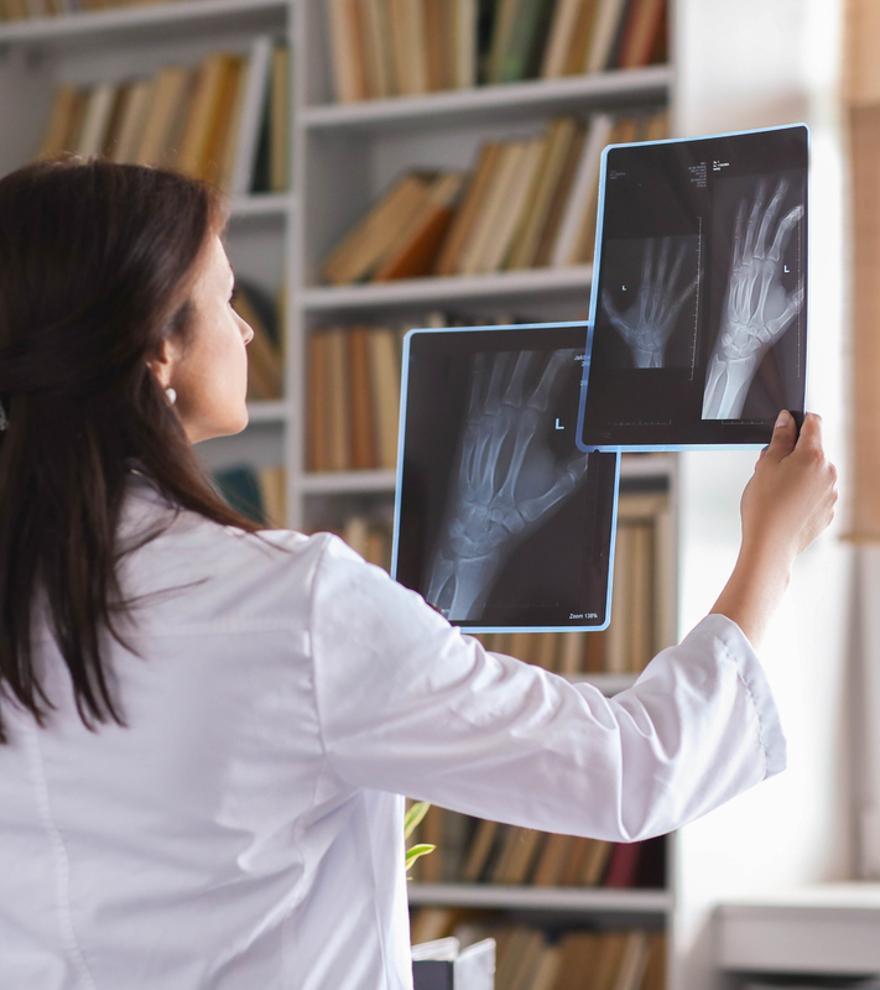 Osteoporosis: cómo prevenir el riesgo de fracturas que llega con la edad, sobre todo en mujeres
