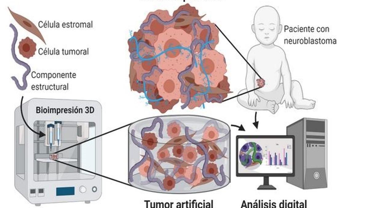 Investigadores españoles estudian la impresión en 3D para comprender el neuroblastoma y otros tumores