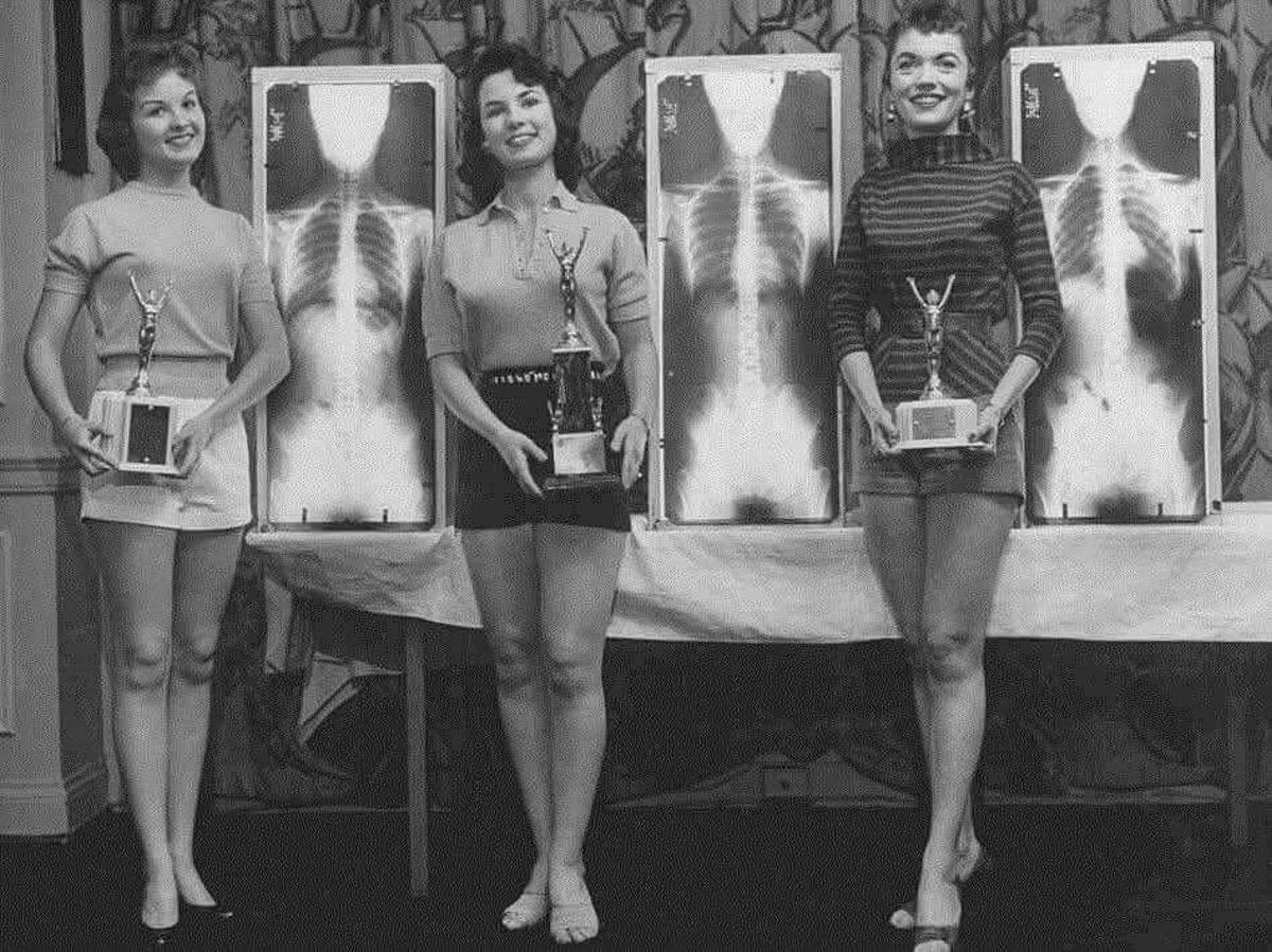 Las ganadoras de un concurso de Miss Rayos X, junto a sus radiografías.