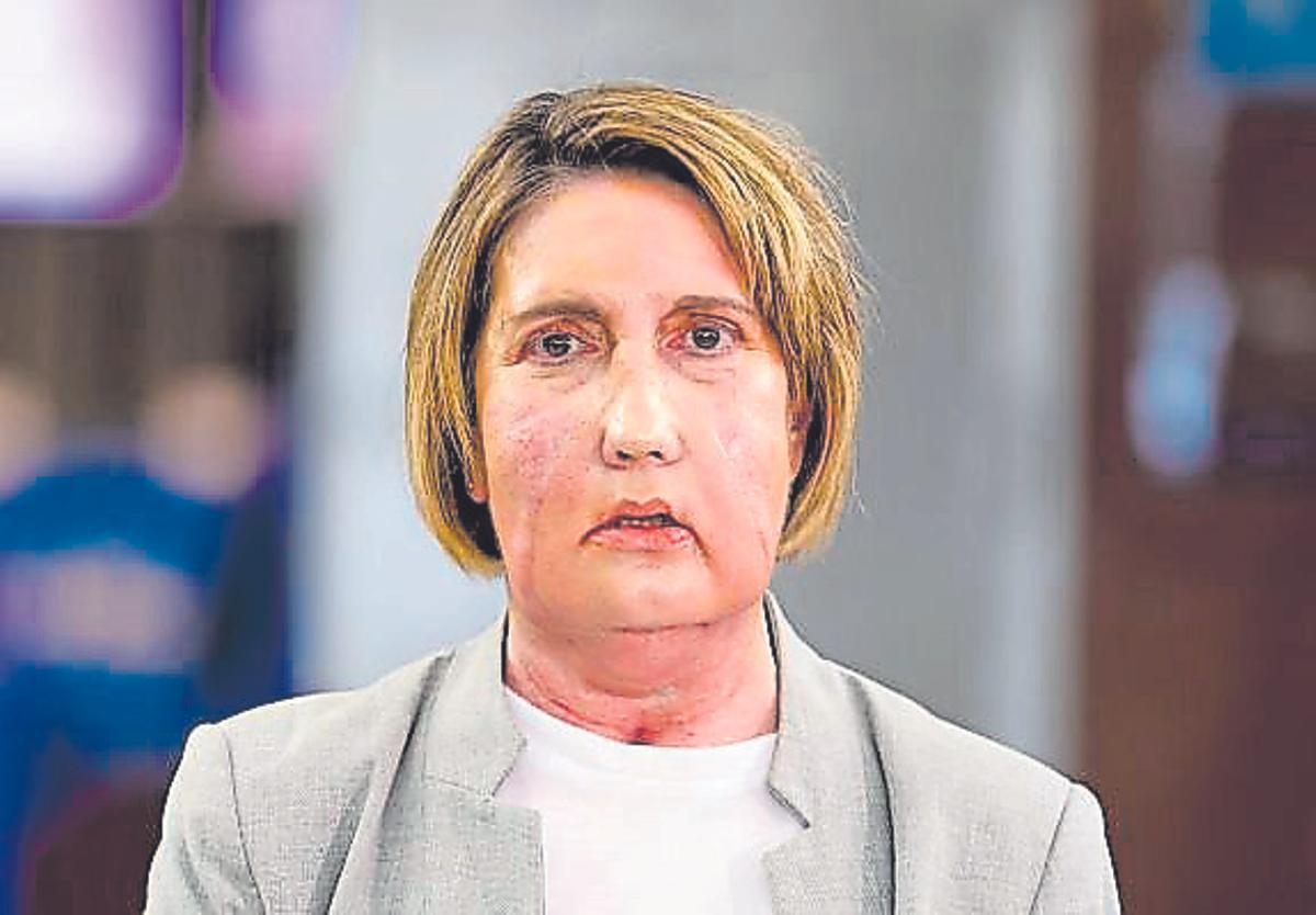 Carme, la mujer trasplantada.